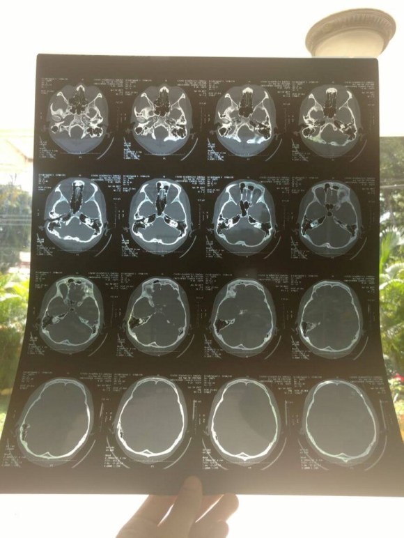 ct-scan-honduras